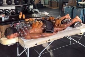 东方神秘力量！尤文前锋奥蓬达拔罐治疗，从脖子到小腿全是罐子