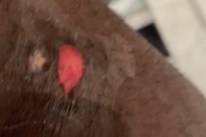 詹姆斯自拍展示右腿上的伤口：可能是年度最佳扑球造成的！好痛！