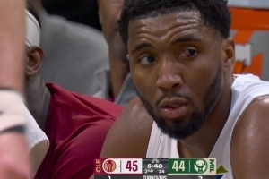 米切尔：我的左眼几乎看不见 得分能力不行想在其他方面帮助球队